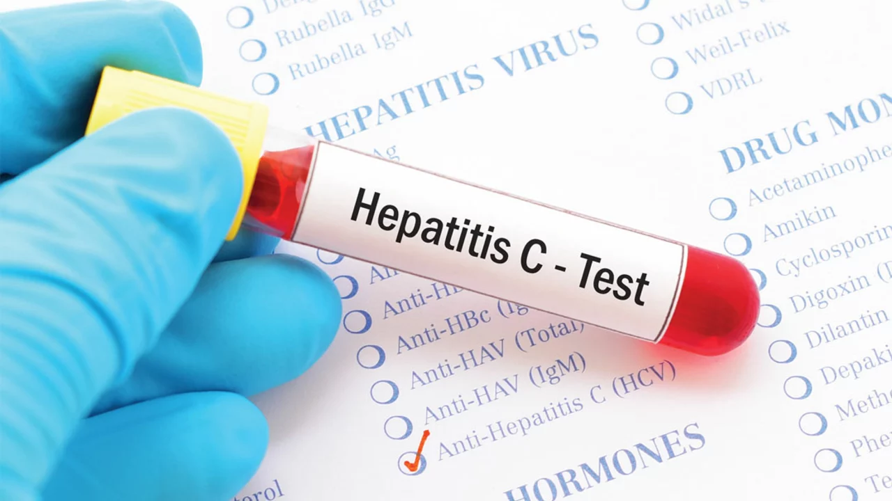El Futuro del Tratamiento de la Hepatitis C: ¿Qué Sigue Después de Velpatasvir?